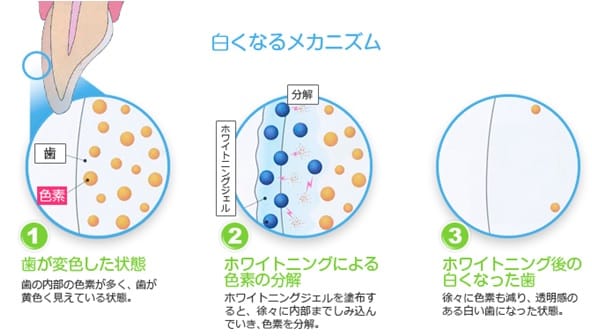 白いはで素敵な笑顔を 二宮デンタルクリニック